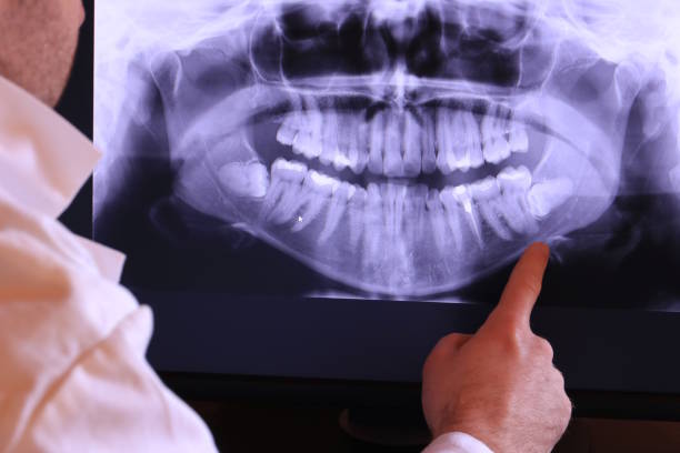 Best Urgent Care for Lost Fillings or Crowns in Shell Lake, WI